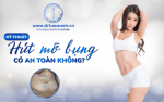 Ky-thuat-hut-mo-bung-co-an-toan-khong-768x480-min.png